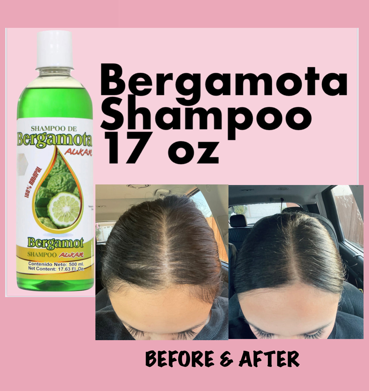 Bergamota SHAMPOO Aukar Organic Hair Loss Shampoo 100% NATURAL 17.63 Oz- Hair Loss